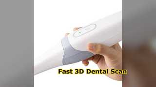 Escáner dental Yucera Escaneo 3D rápido