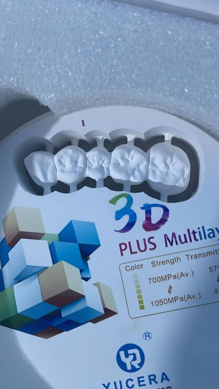 Yucera Multilayer Zirconia Blocks 3D Pro - Durable and Aesthetic Dental Ceramic
