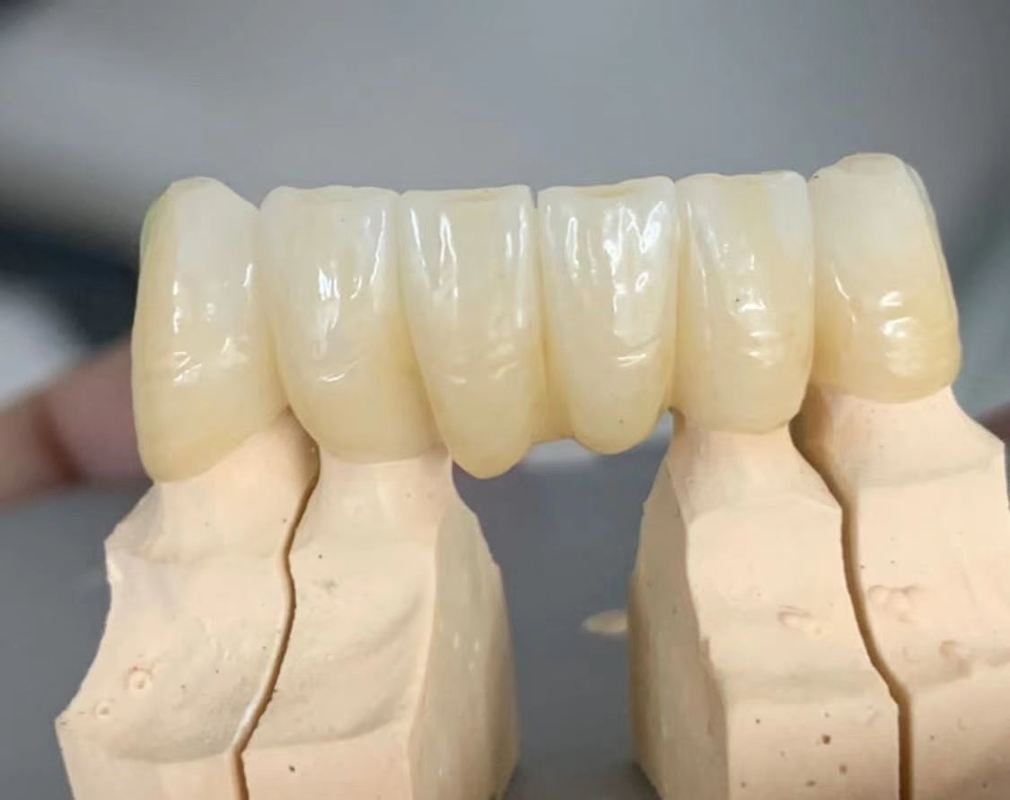 Bloques de zirconia dental multicapa 3D Plus de 98 mm YUCERA, los mejores materiales de discos de zirconia dental para el sistema CAD/CAM de laboratorio