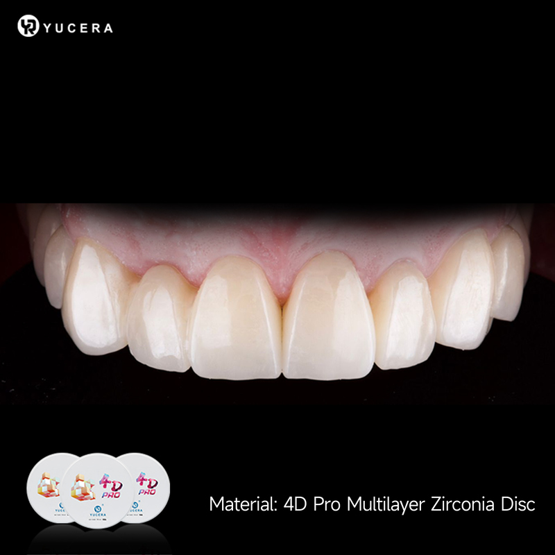 Disco de zirconia Yucera High Translucent 98mm para corona y puente dental con 1200MPa de resistencia, grado de laboratorio