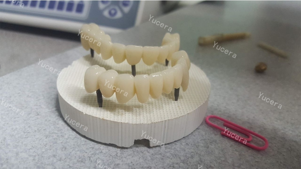 Yucera 4D Pro Multicapa de Cerámica de Zirconio Dental Sistema Abierto 98mm para Laboratorio Dental y Clínica