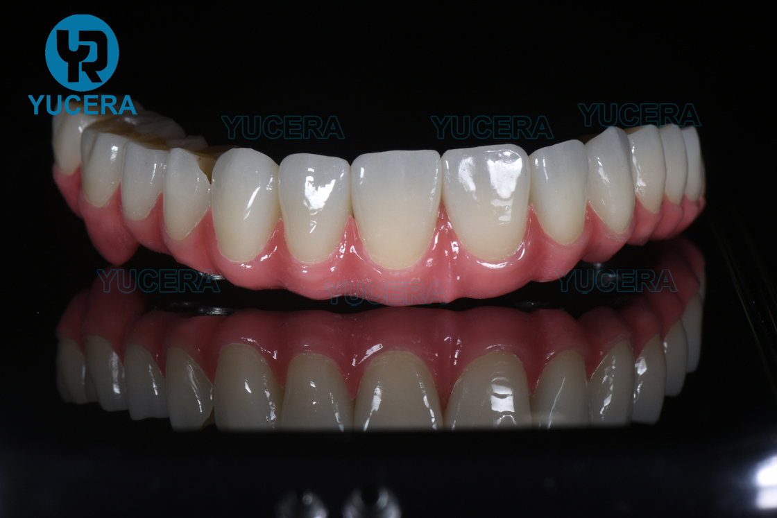 YUCERA Máquina de Fresado CAD CAM Dental y Fabricante de Materiales y Equipos CAD CAM Dental Máquina de Fresado para Laboratorio Dental