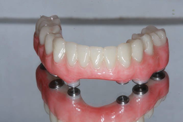 Bloques de PMMA Dental Yucera 98*22mm  CADCAM Multicapa PMMA Disco Rosa