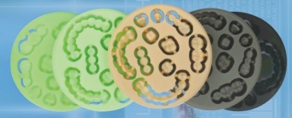 Yucera Materiales Dentales PMMA Bloque Dental Sistema de Pluma para Restauración de Belleza Alto Rendimiento