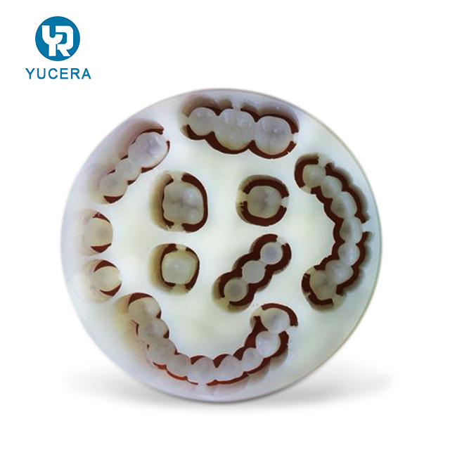 PMMA Monocapa Dental Yucera Superior que Asegura un Alto Rendimiento en la Fabricación de Prótesis