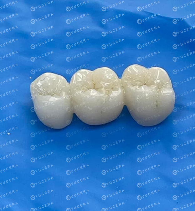 Máquina Cam Yucera para Laboratorio Dental Horno de Sinterización Dental para Material de Zirconia
