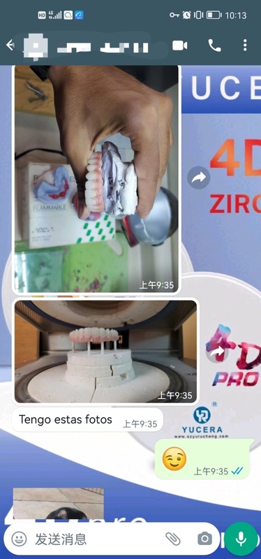 Yucera 4D Pro Alta - Transparencia y Alto - Brillo Bloque de Cerámica de Zirconio Dental Comparable a Dientes Reales