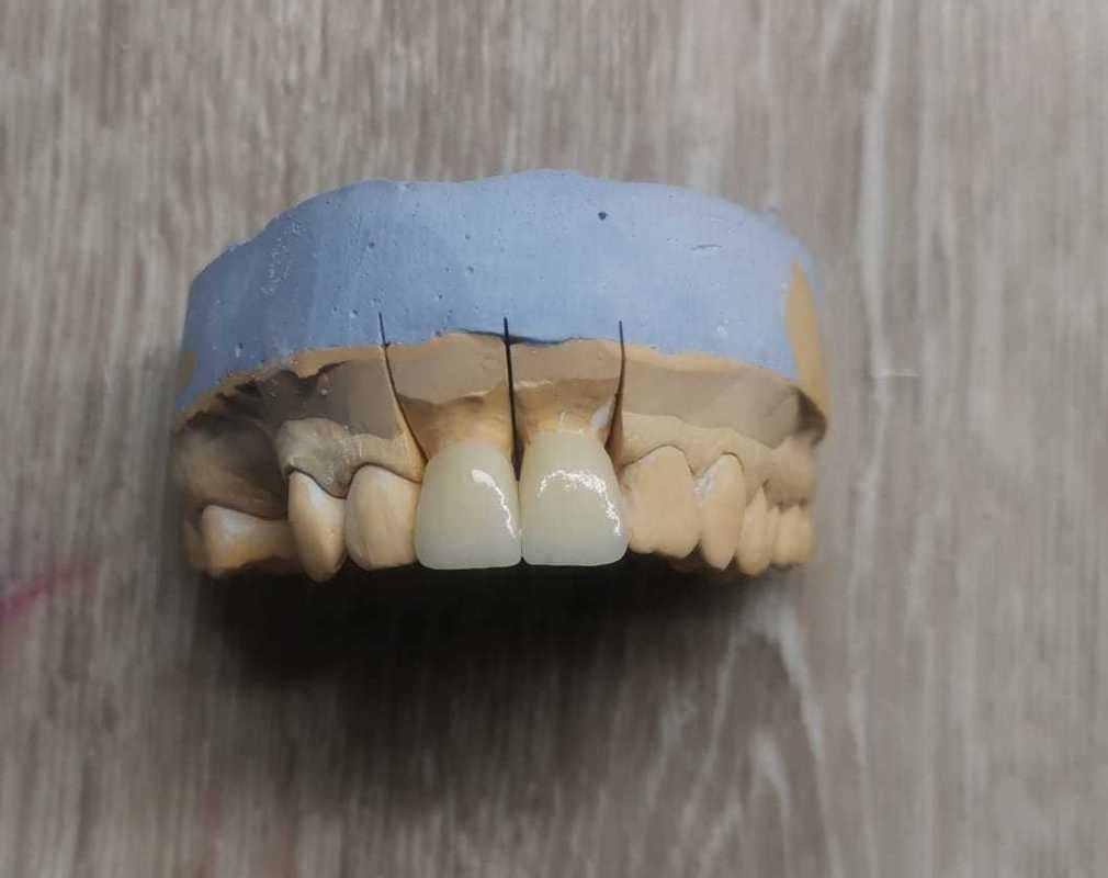 Discos de zirconia dental ST color Yucera perfectamente combinados con nuestros bloques de alta calidad