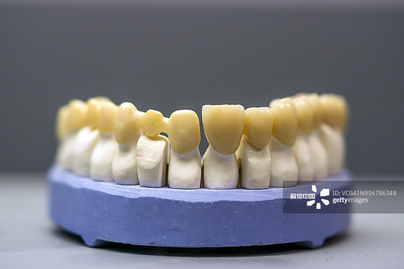 Confíe en los materiales de zirconia STwhite de Yucera para resultados dentales duraderos y estéticamente superiores