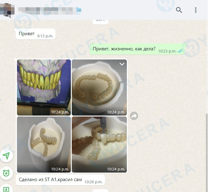 Yucera 4D Pro High - Bloque de zirconia dental multicapa 3D de alta precisión, estable y confiable, que crea resultados de restauración ideales