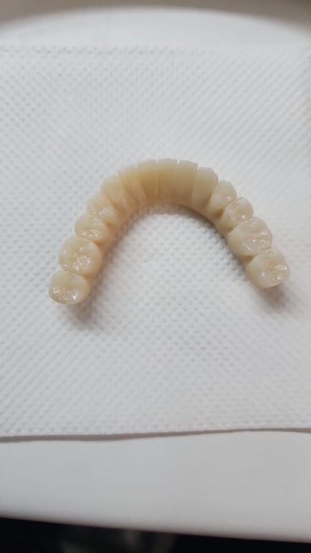 Yucera 4D Pro High - Bloque de zirconia dental multicapa 3D de alta precisión, estable y confiable, que crea resultados de restauración ideales