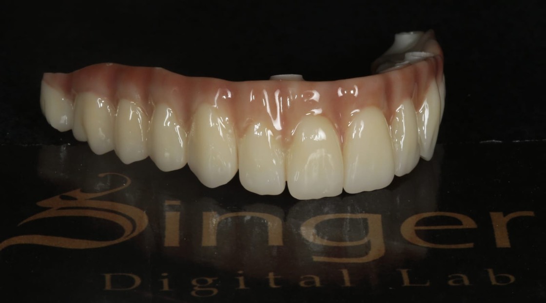 Bloque de Zirconia 4D Pro Yucera para laboratorios dentales profesionales, con múltiples especificaciones disponibles y calidad garantizada